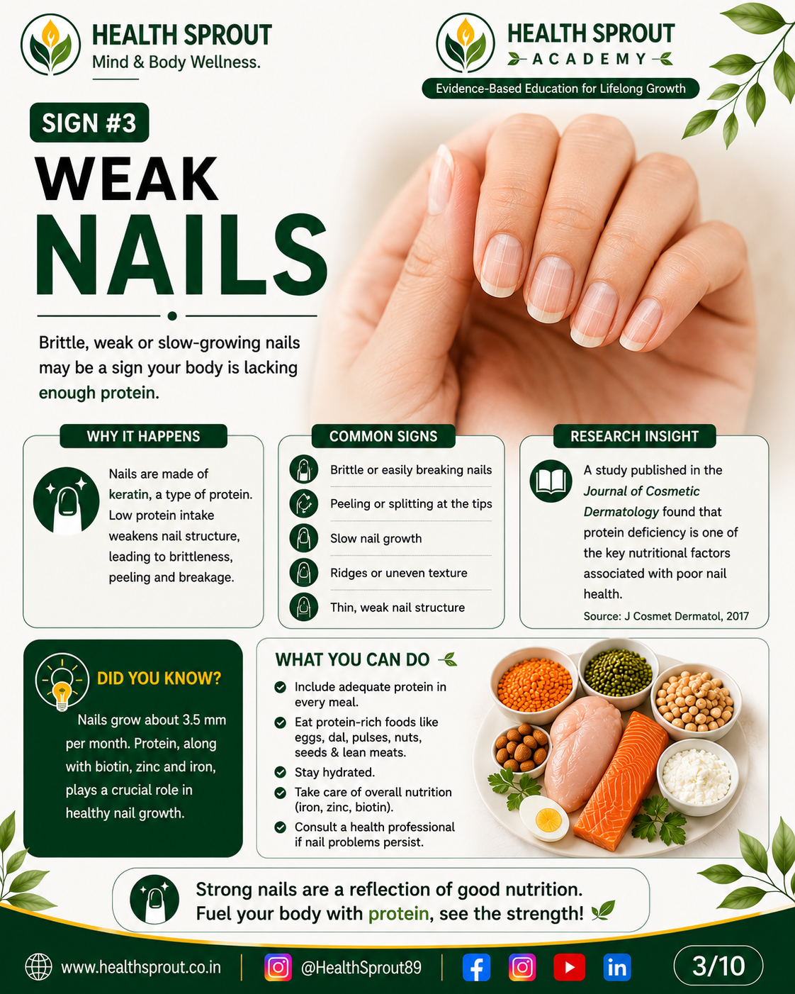 Sign 3 — Weak Nails